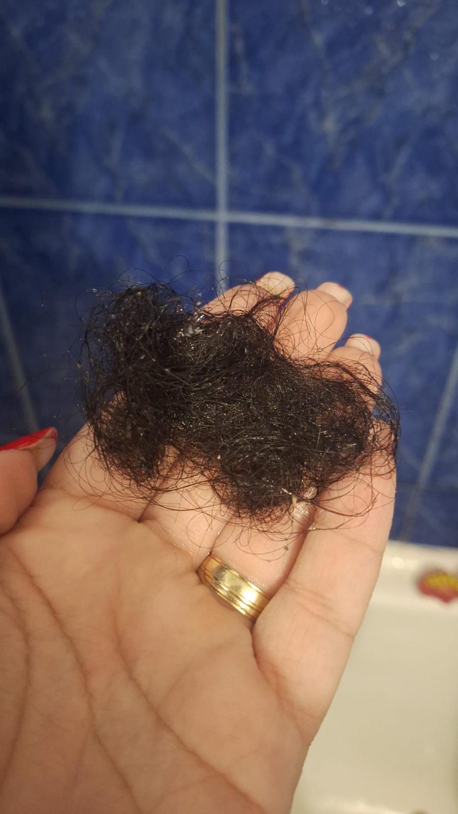 Înainte de rutina Regen Expert — păr rărit în zona creștetului